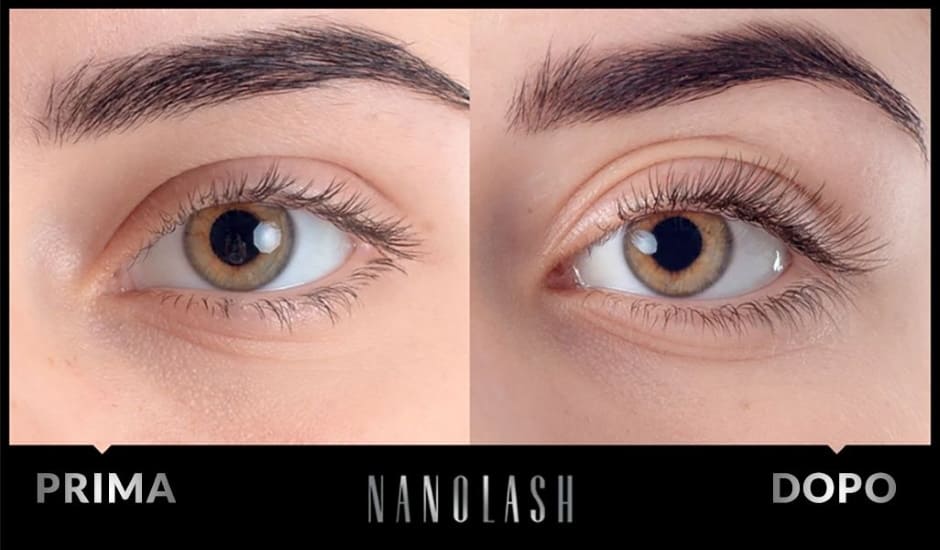 Siero Nanolash prima e dopo